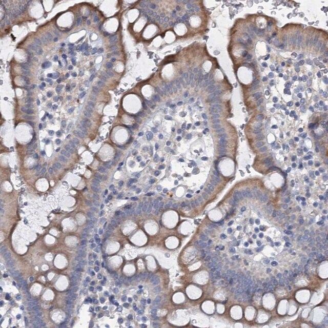 Anti-URAD antibody produced in rabbit