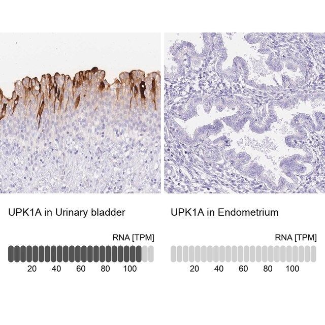 Anti-UPK1A antibody produced in rabbit
