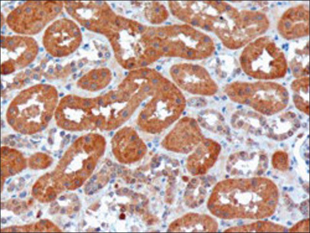 Anti-USH1C/Harmonin antibody produced in goat