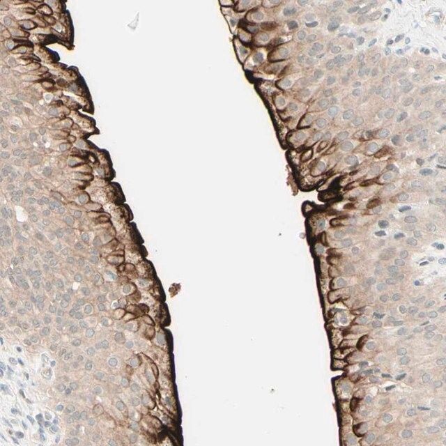 Anti-UPK3B antibody produced in rabbit