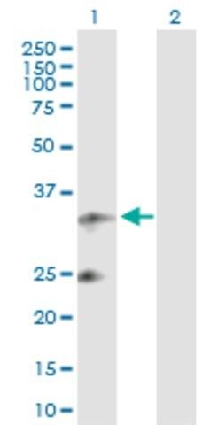 Anti-UQCRFS1 antibody produced in rabbit