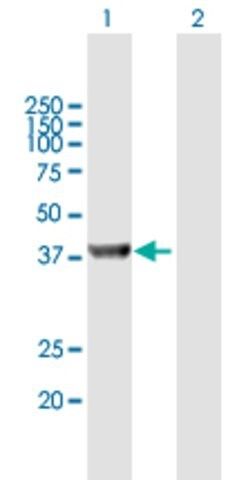 Anti-UROD antibody produced in mouse