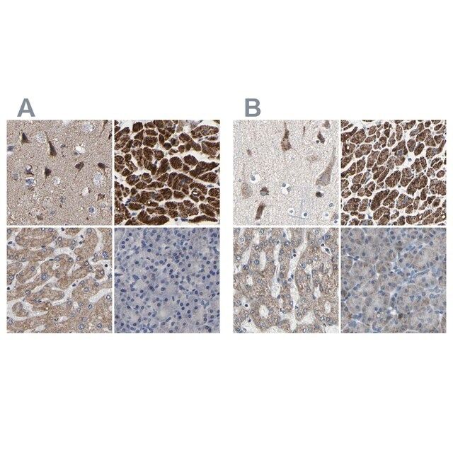 Anti-UQCRC2 antibody produced in rabbit