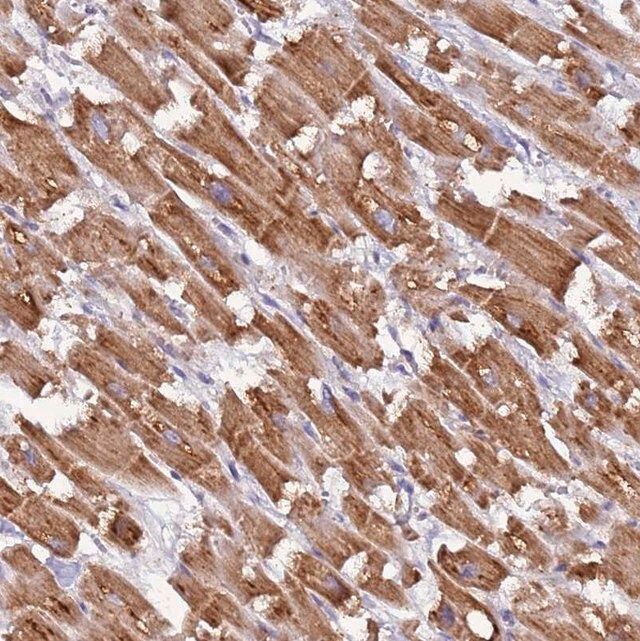 Anti-UQCRQ antibody produced in rabbit