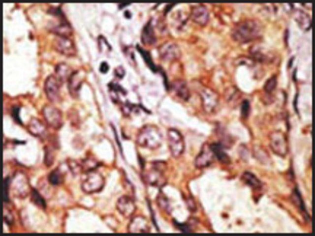 Anti-URM1 (N-term) antibody produced in rabbit