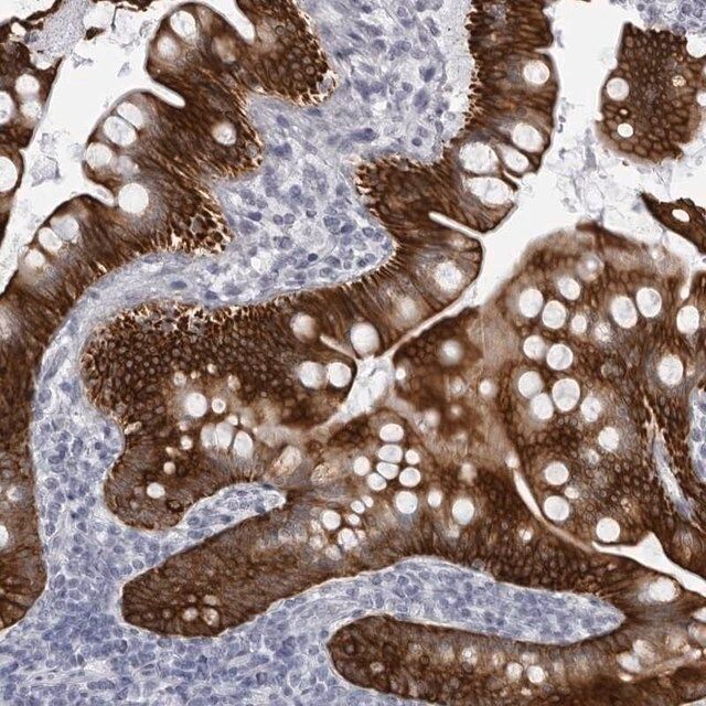 Anti-UROD antibody produced in rabbit