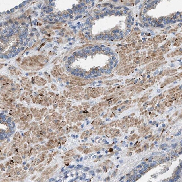 Anti-URGCP antibody produced in rabbit