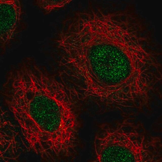 Anti-USB1 antibody produced in rabbit