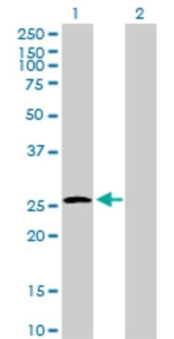 Anti-UROS antibody produced in mouse