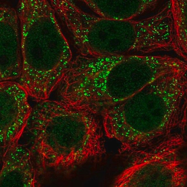 Anti-URM1 antibody produced in rabbit