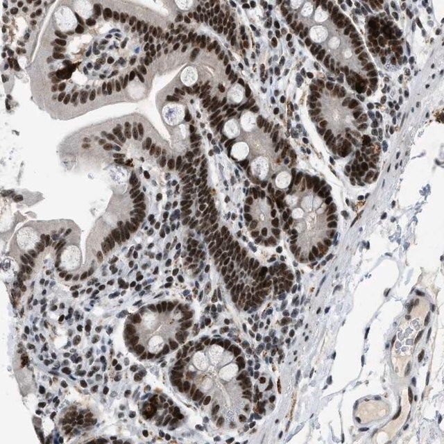 Anti-URB1 antibody produced in rabbit