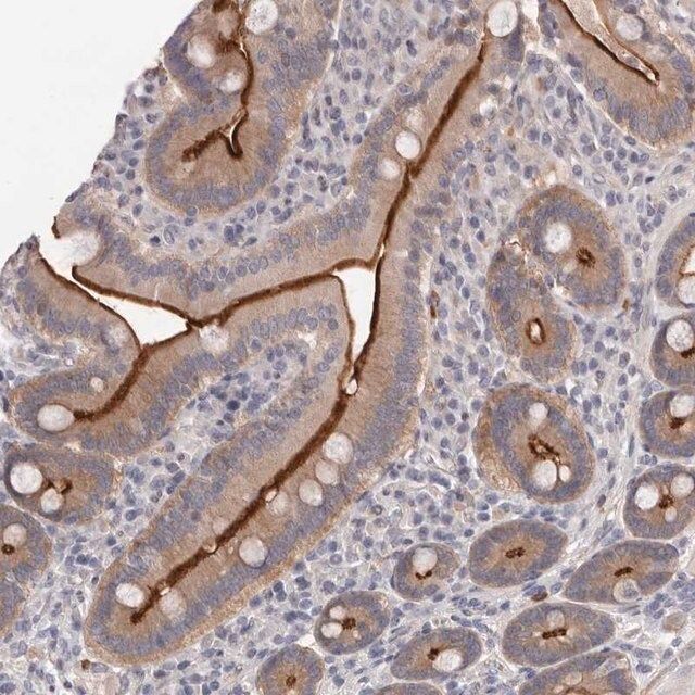Anti-USH1C antibody produced in rabbit