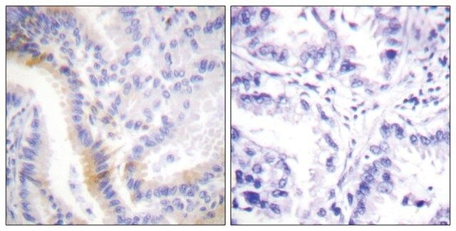 Anti-Urocortin antibody produced in rabbit