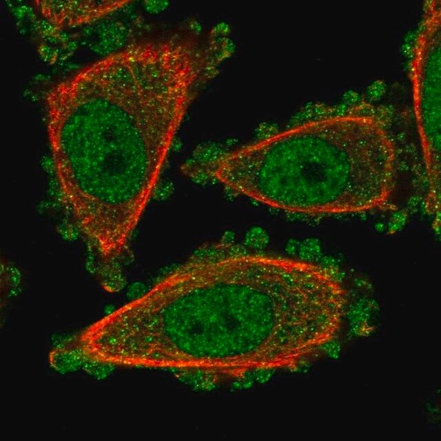 Anti-UROD antibody produced in rabbit