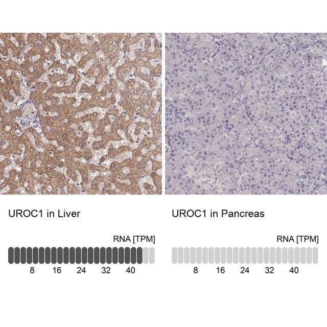 Anti-UROC1