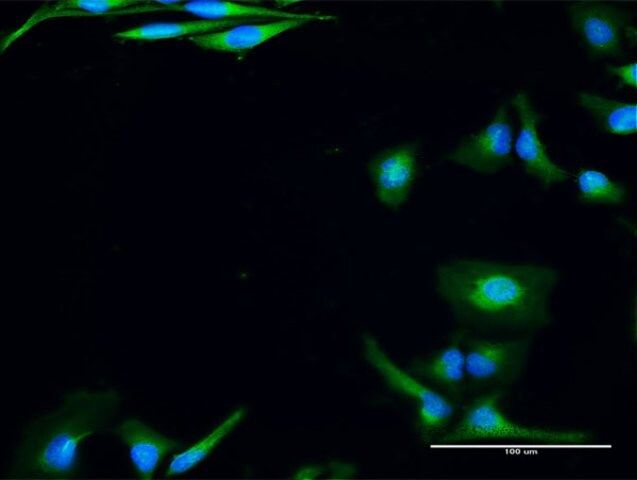 Anti-USE1 antibody produced in rabbit