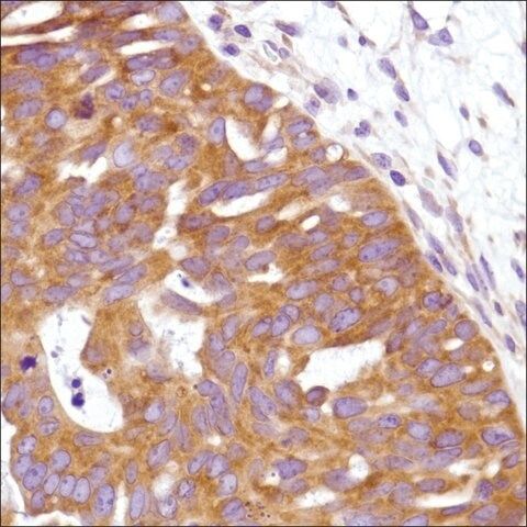 Anti-URI antibody, Rabbit monoclonal