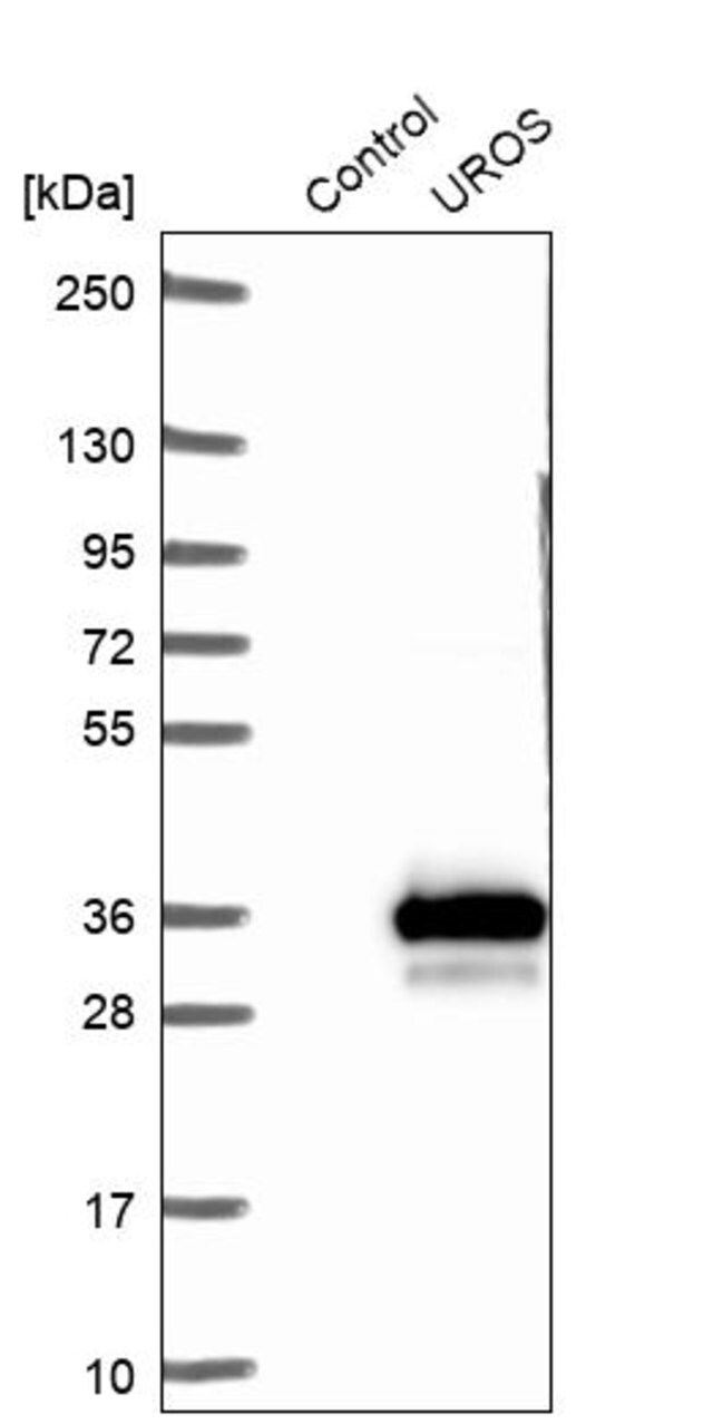 Anti-UROS antibody produced in rabbit