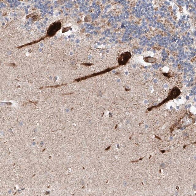 Anti-USF3 antibody produced in rabbit