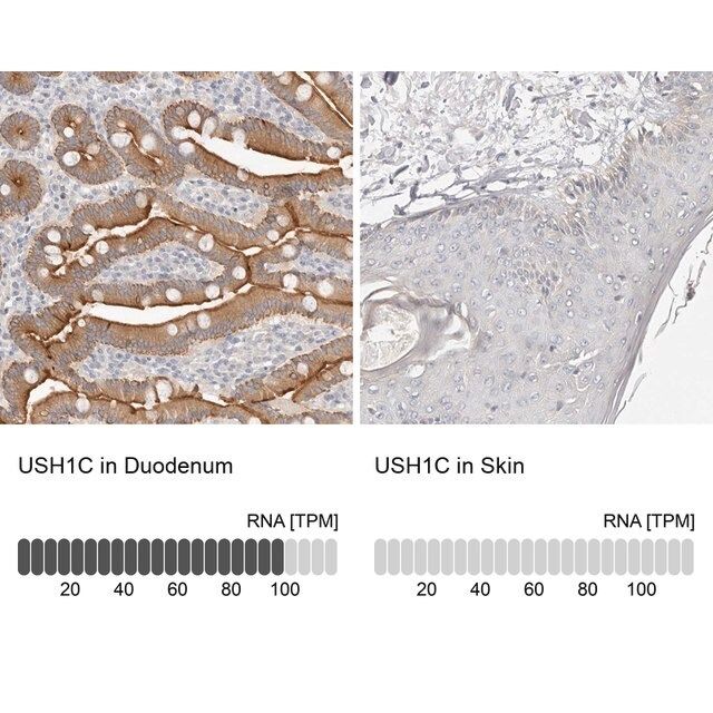 Anti-USH1C antibody produced in rabbit