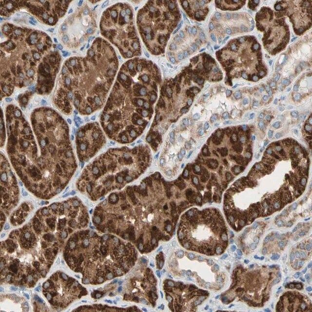 Anti-URB2 antibody produced in rabbit
