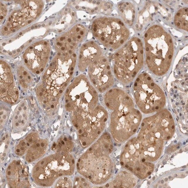 Anti-UROD antibody produced in rabbit