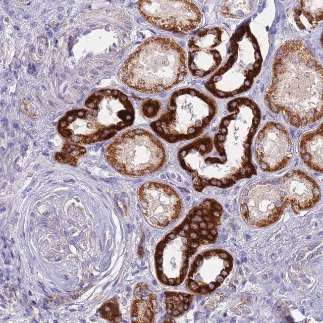 Anti-UQCRH antibody produced in rabbit