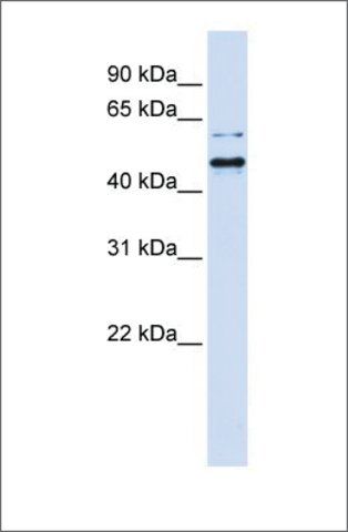 Anti-TUB (ab1) antibody produced in rabbit