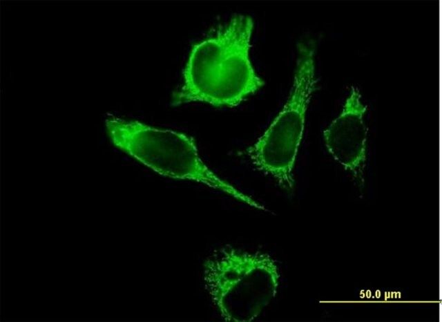 Anti-TUFM antibody produced in mouse