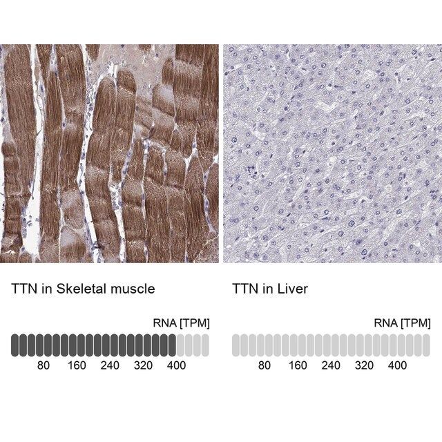 Anti-TTN antibody produced in rabbit