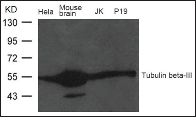 Anti-Tubulin β-III antibody produced in rabbit