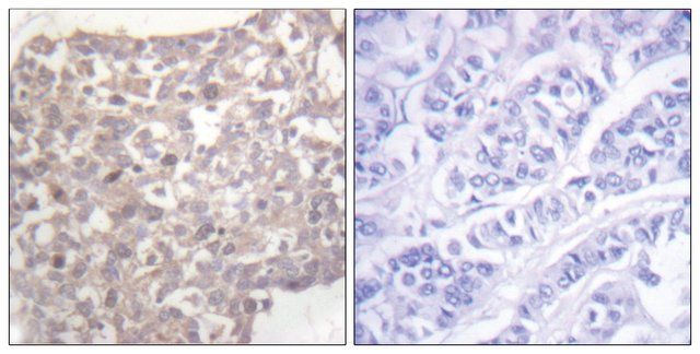 Anti-Tubulin γ, C-Terminal antibody produced in rabbit