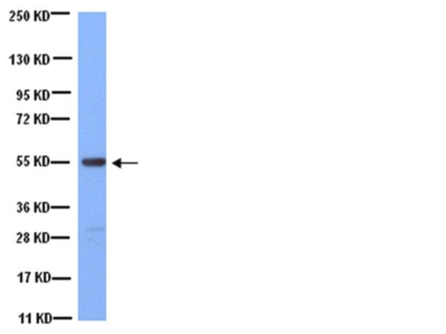Anti-Tubulin Antibody, clone YL1/2
