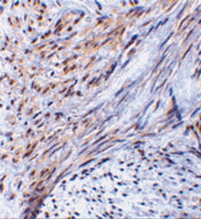 Anti-TRIM5 alpha antibody produced in rabbit