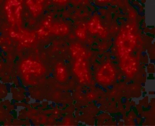 Anti-TRIM5 alpha antibody produced in rabbit