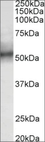 Anti-TRIM11 antibody produced in goat