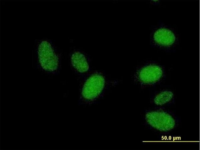 ANTI-TRIM69 antibody produced in mouse