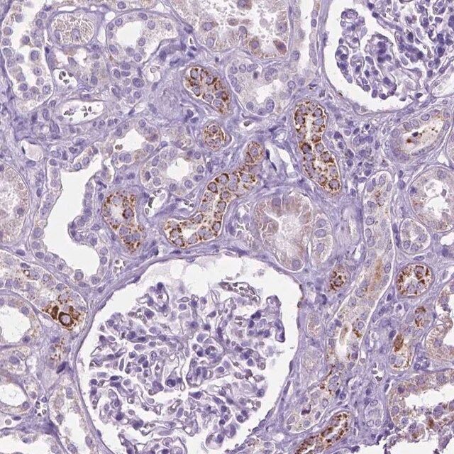 Anti-TMEM132E antibody produced in rabbit