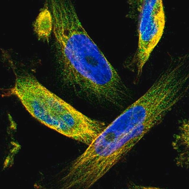 Anti-TMEM132C antibody produced in rabbit