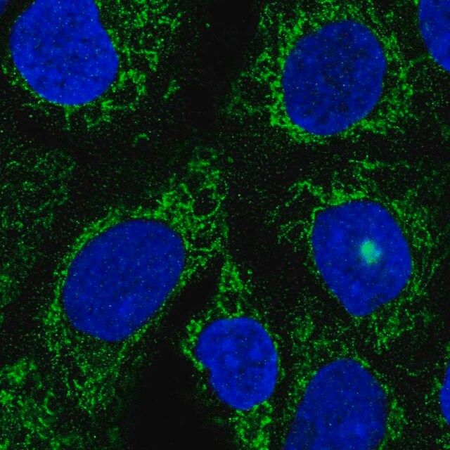 Anti-TMLHE antibody produced in rabbit