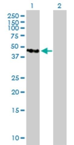 Anti-TMOD4 antibody produced in mouse
