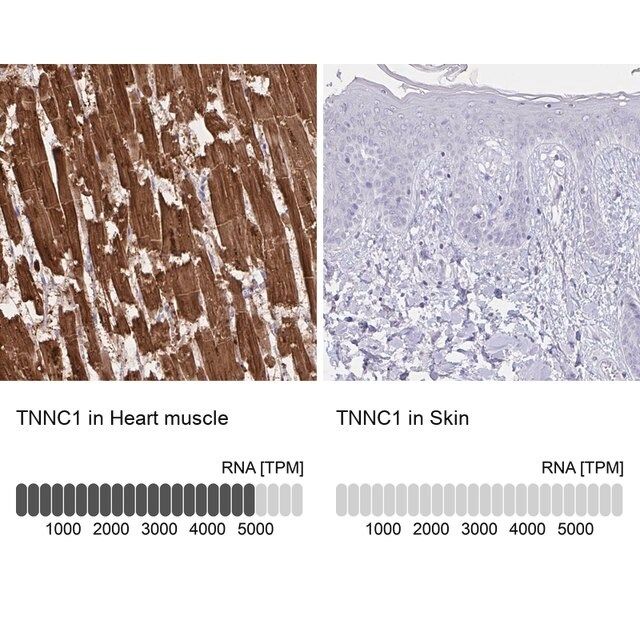 Anti-TNNC1 antibody produced in rabbit