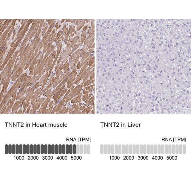 Anti-TNNT2 antibody produced in rabbit