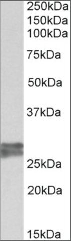 Anti-TNNI3 antibody produced in goat