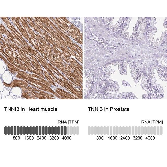 Anti-TNNI3 antibody produced in rabbit