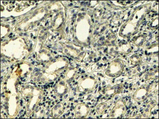 Anti-TNS1 (C-terminal) antibody produced in goat