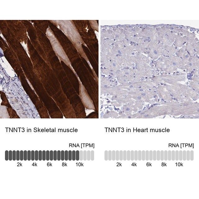 Anti-TNNT3 antibody produced in rabbit