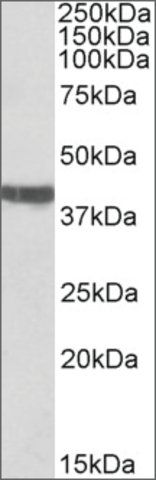 Anti-TNNT2 (C-terminal) antibody produced in goat