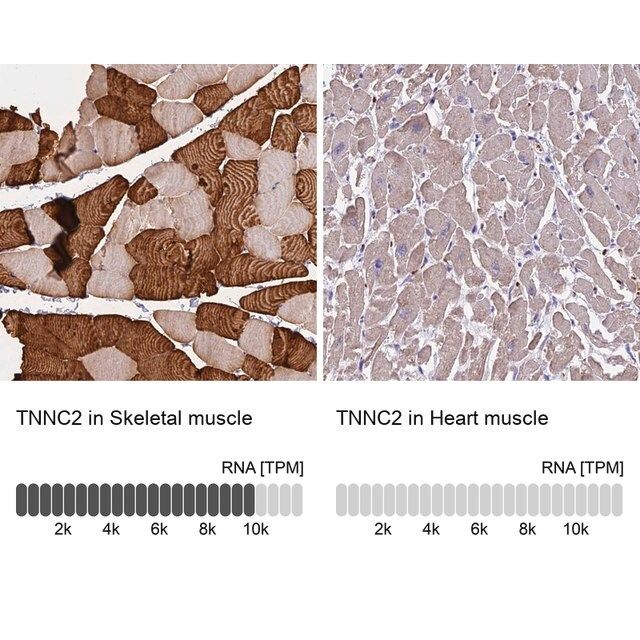 Anti-TNNC2 antibody produced in rabbit