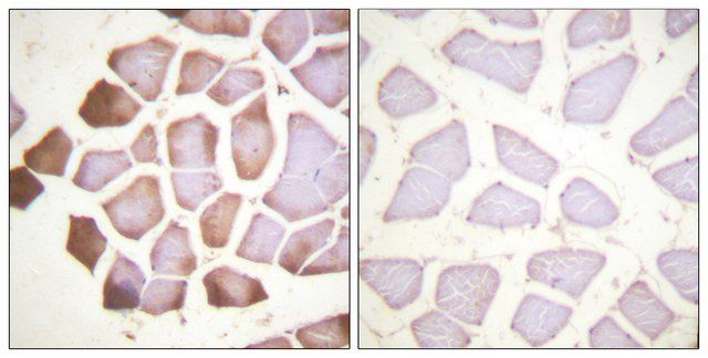 Anti-Tnni3, N-Terminal antibody produced in rabbit